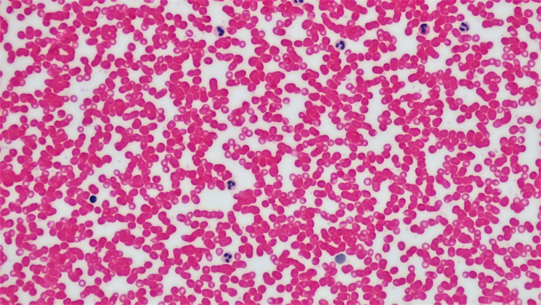 Photo familial hypercholesterolemia
